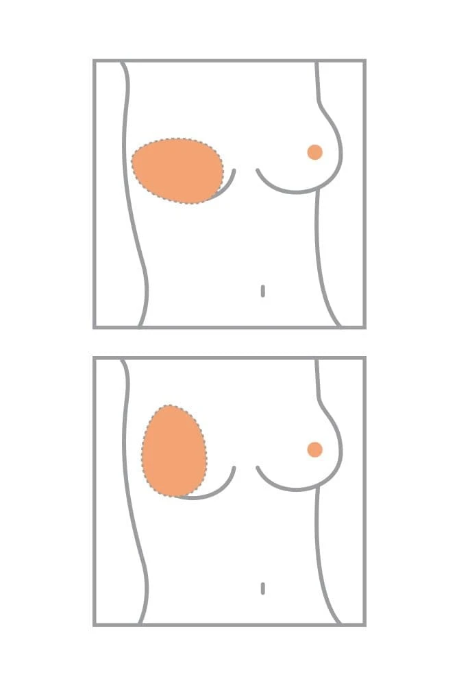 Amoena Teilprothese Balance Essential Thin Oval 5 Amoena Teilprothese Balance Essential Thin Oval – Bild 3