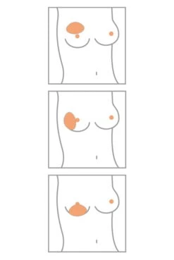 Amoena Teilprothese Balance Adapt Air Spezial Varia -Unterwäsche Verkäufe 2024 Amoena Brustprothesen Form Varia min 1280x1280 2